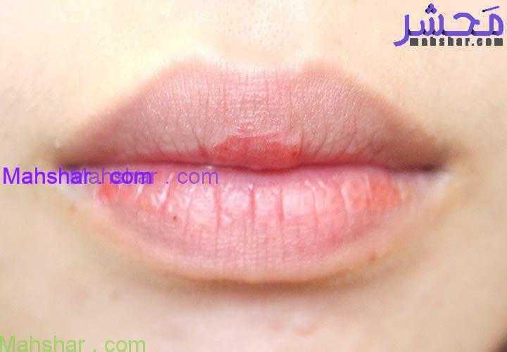 pale lips 5 علائم کمبود ویتامین در صورت شما