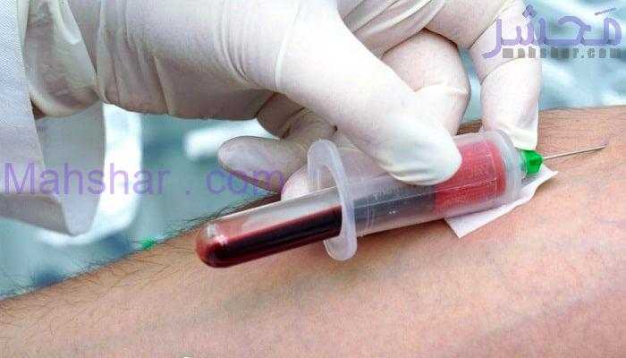 خون 3 انواع آزمایش خون