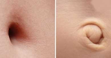 هرکسی منحصر به فرد است 4 هرکسی منحصر به فرد است 3 ناف هرکسی منحصر به فرد است